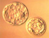 blastocyst100.jpg